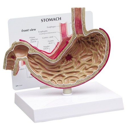 GPI ANATOMICAL Anatomical Model - Stomach 2000